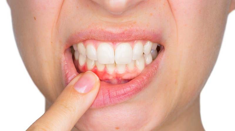 Denti e non solo, la parodontologia!