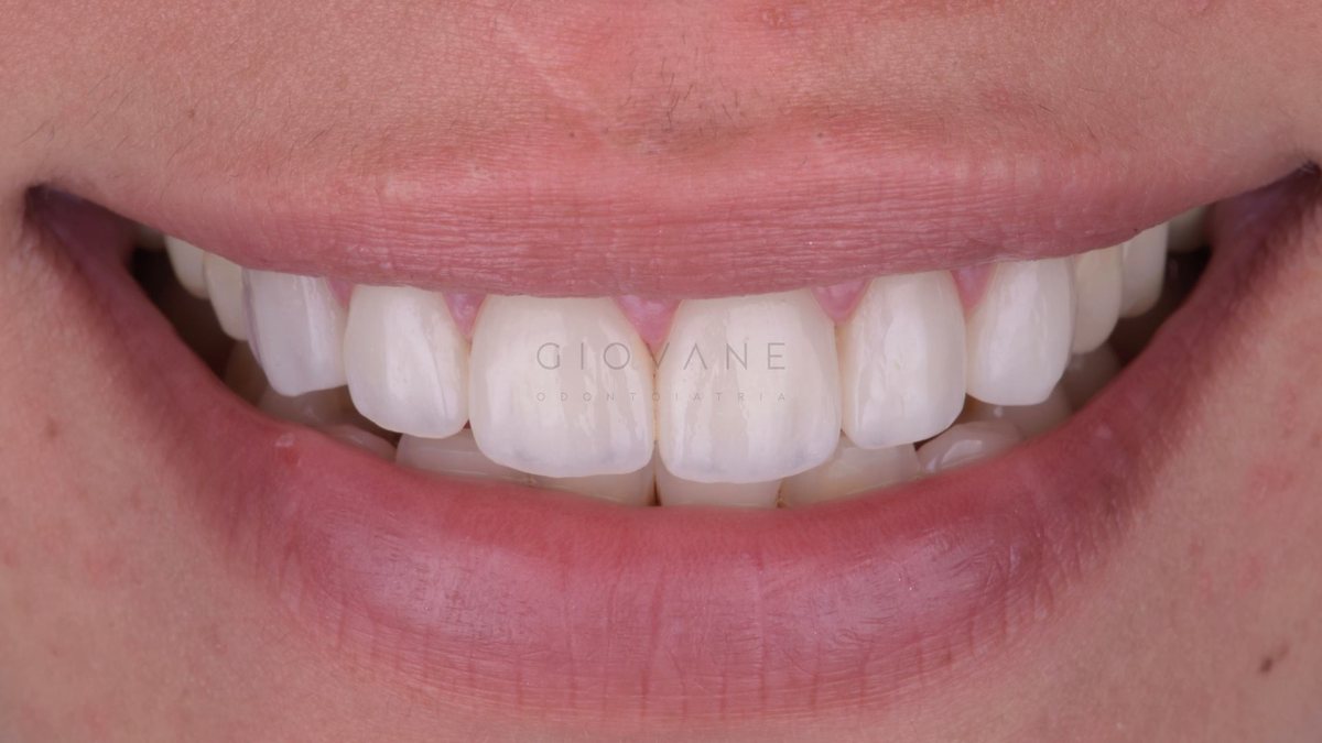 Un sorriso a trentadue denti perfetti!